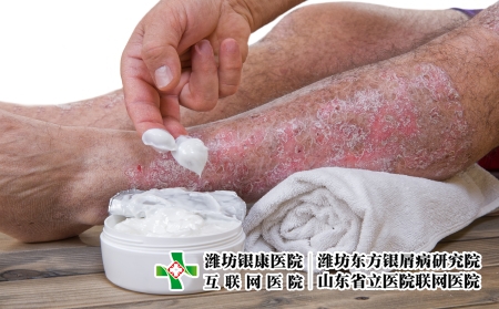 攝圖網(wǎng)_502709980_皮絲蟲病是皮膚慢發(fā)炎疾病（企業(yè)商用）