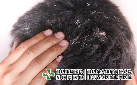 攝圖網(wǎng)_330166077_頭發(fā)上涂著脫衣男裝的男子皮膚科真菌頭皮醫(yī)療藥品薄片皮膚洗發(fā)水衛(wèi)生分泌（企業(yè)商用）