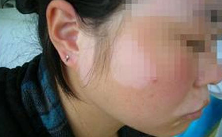 治白癜風,濰坊治白癜風,治療白癜風醫院,白癜風哪家醫院專業